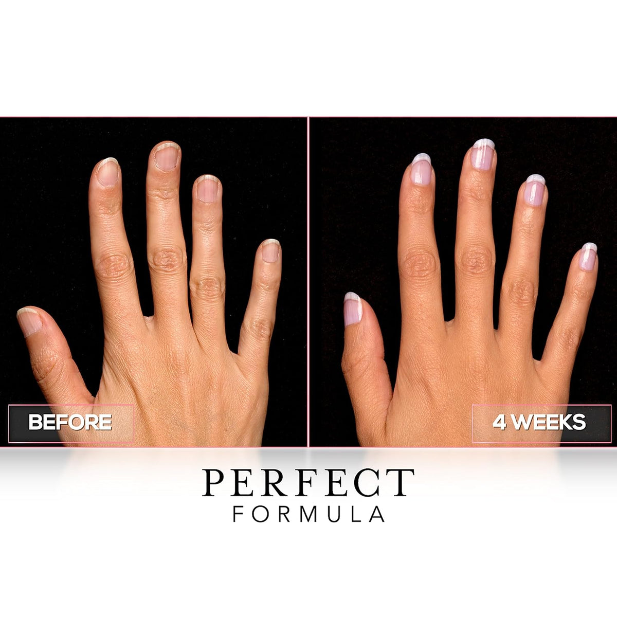 Perfect Formula Clear Gel Coat - Nail Strengthener, Keratin Treatment, Clear Nail Polish