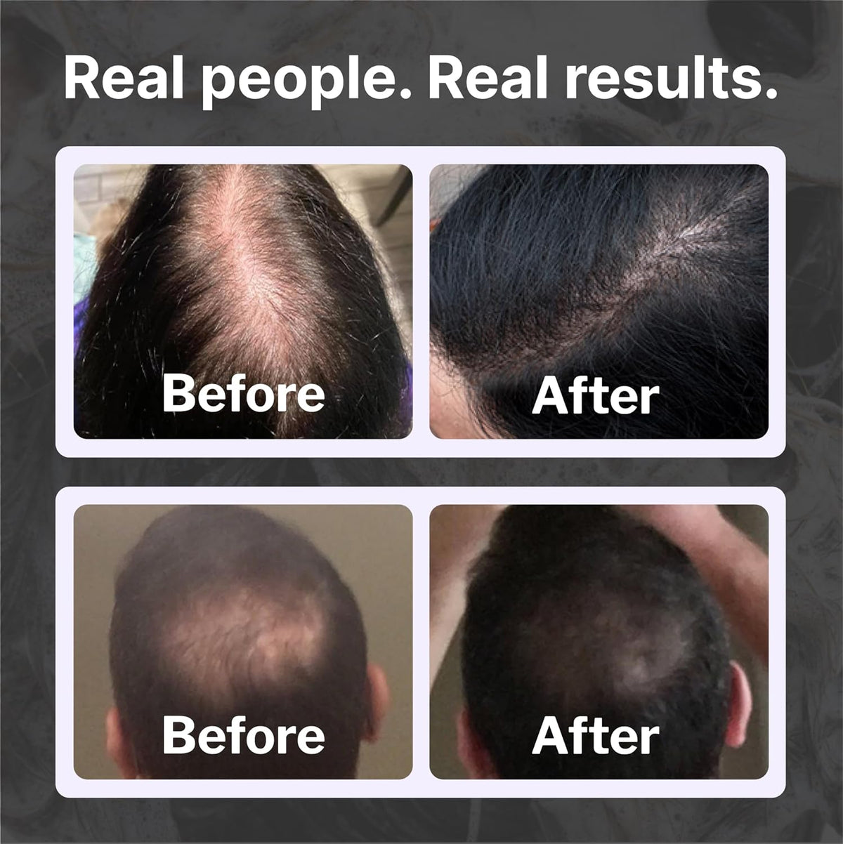 Shapiro MD Hair Growth Experts Hair Loss Shampoo | DHT Fighting Vegan Formula for Thinning Hair