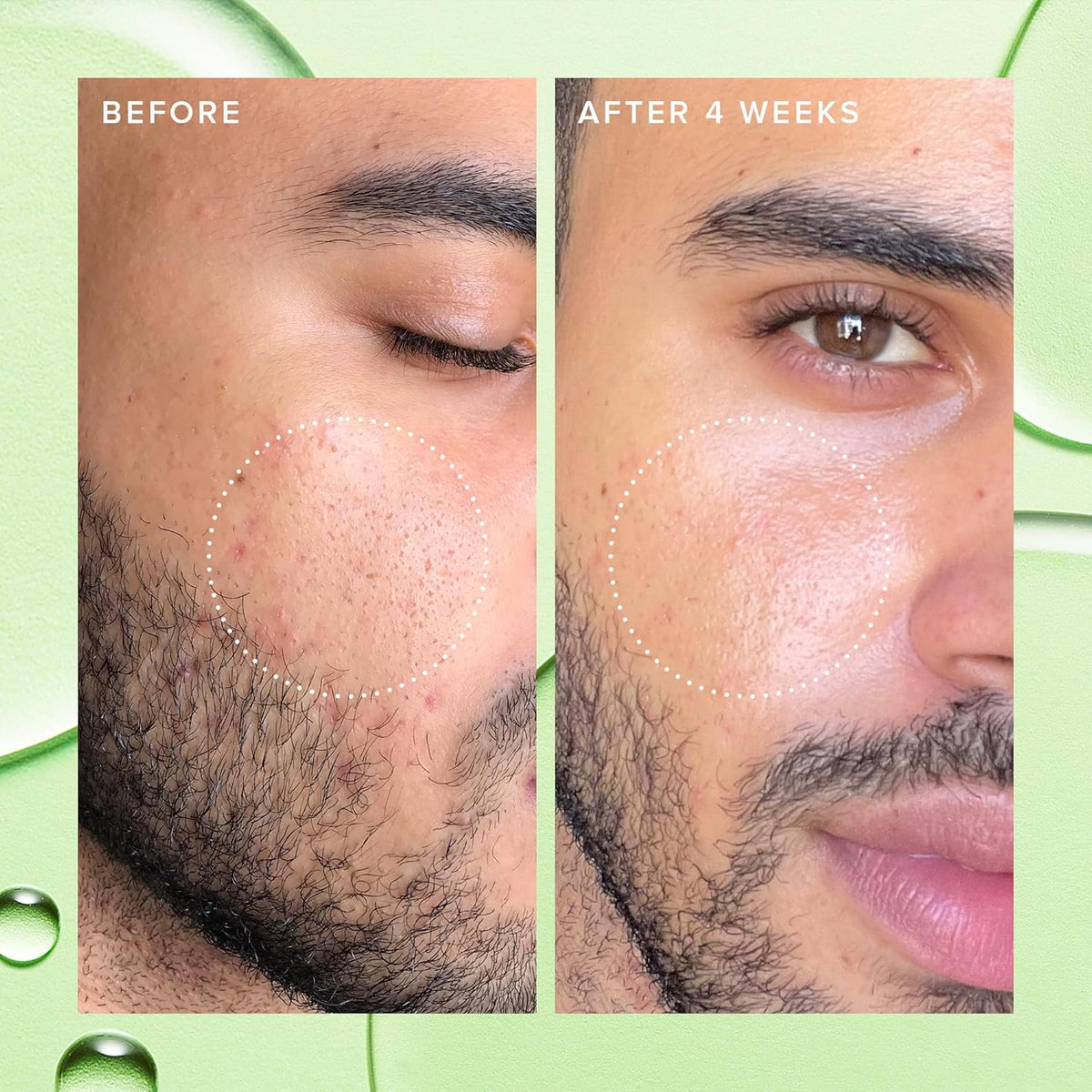 Farmacy 2% Salicylic Acid Toner for Face - Deep Sweep Gentle BHA Exfoliant for Oily Skin - Refines