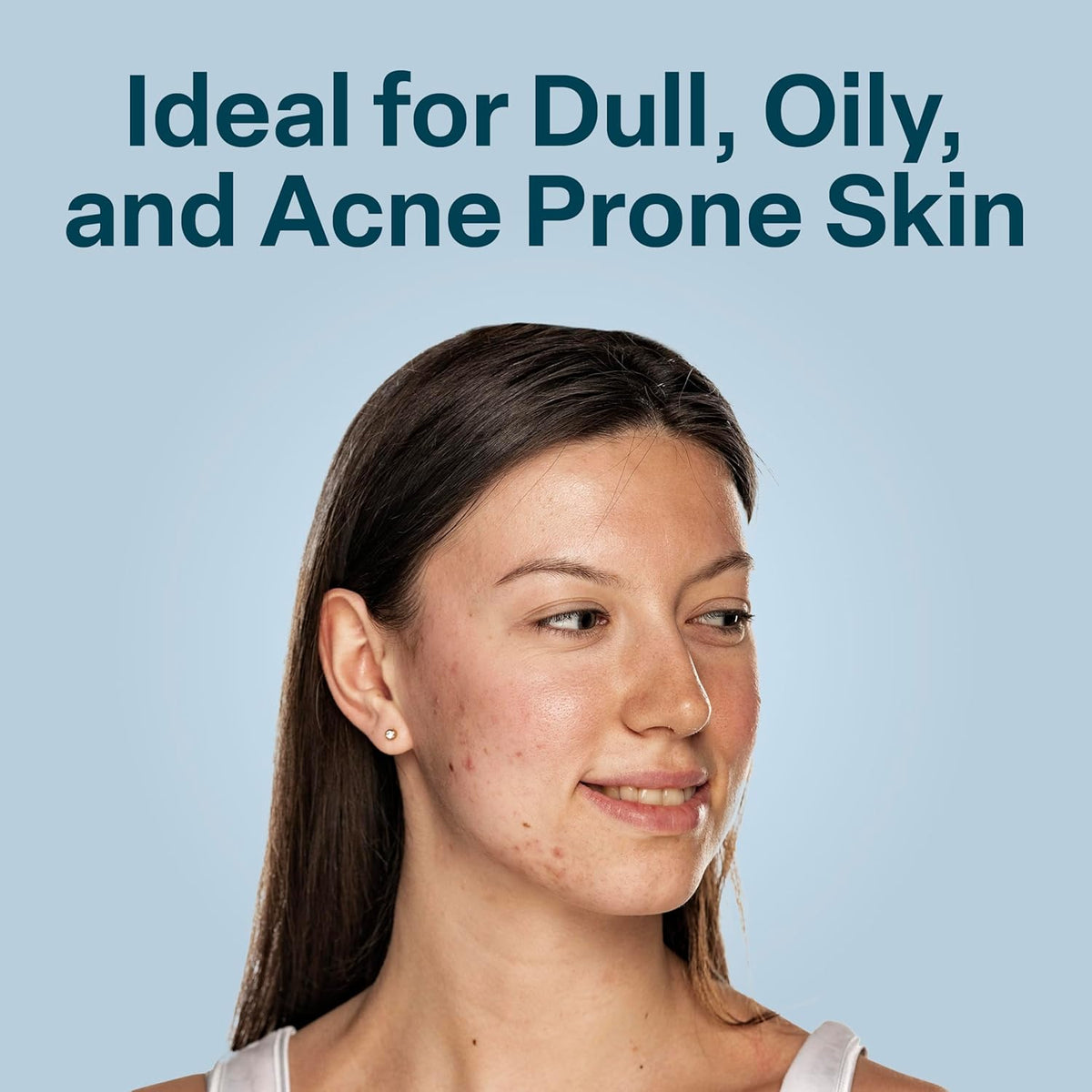 QRxLabs Glycolic Acid Toner - 6 fl oz - Exfoliating Face Toner with Witch Hazel & Salicylic Acid