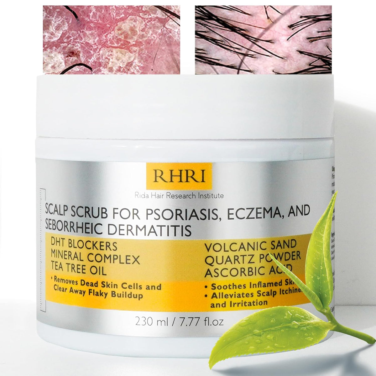 Anti Fungal Pre Shampoo Scalp Scrub for Psoriasis, Eczema & Seborrheic Dermatitis | DHT Blockers