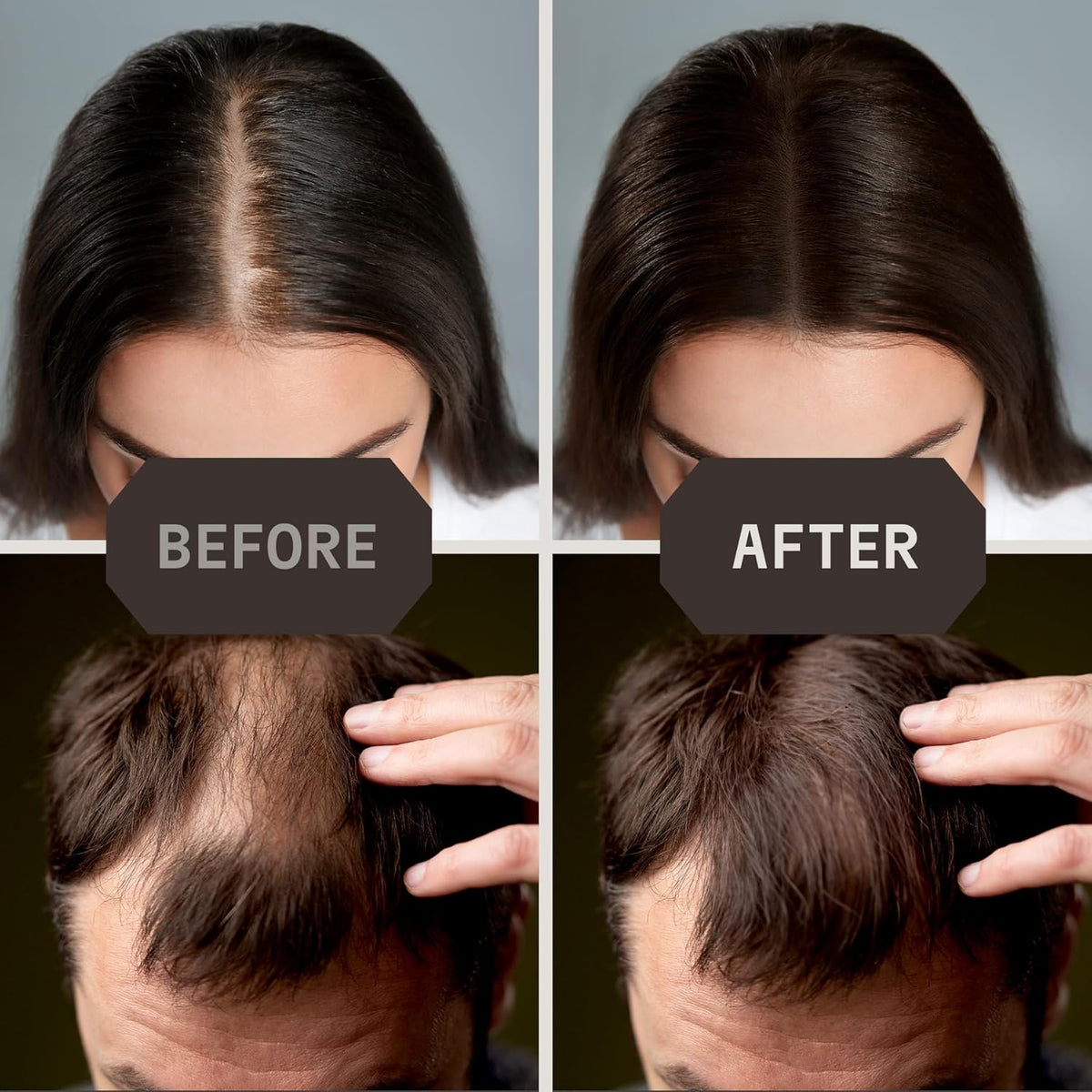 Striking Viking Hair Fibers for Thinning Hair - 28 g, Medium Brown - Bald Spot Cover Up &