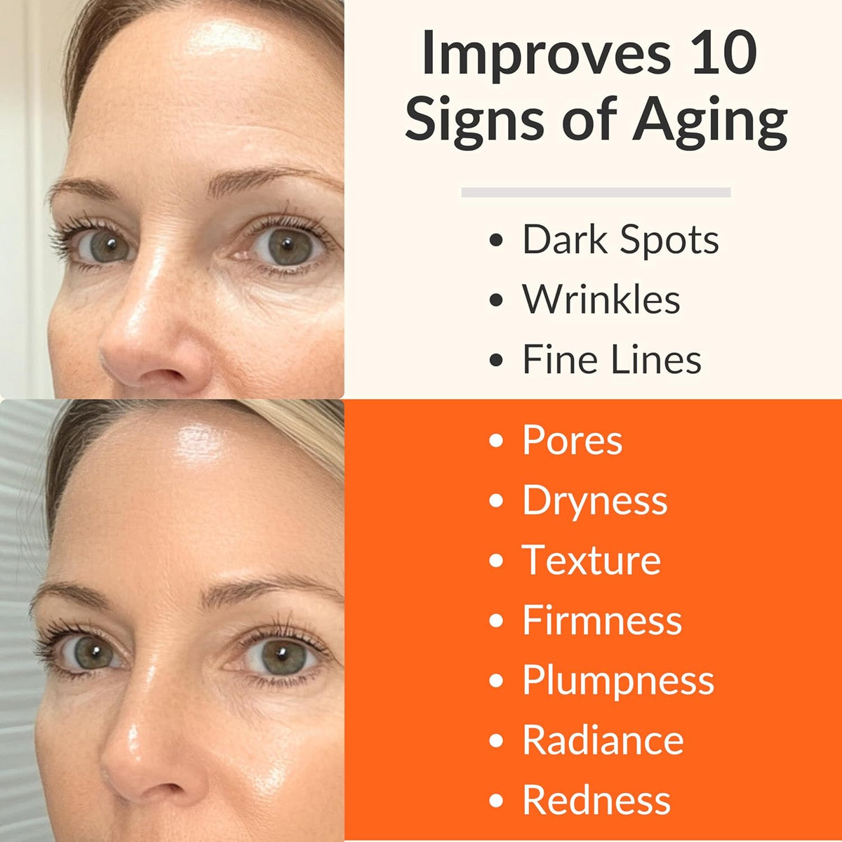 LeVaye Vitamin C Serum, Anti-Aging Face Serum – 15% Vitamin C, Ferulic Acid, Niacinamide