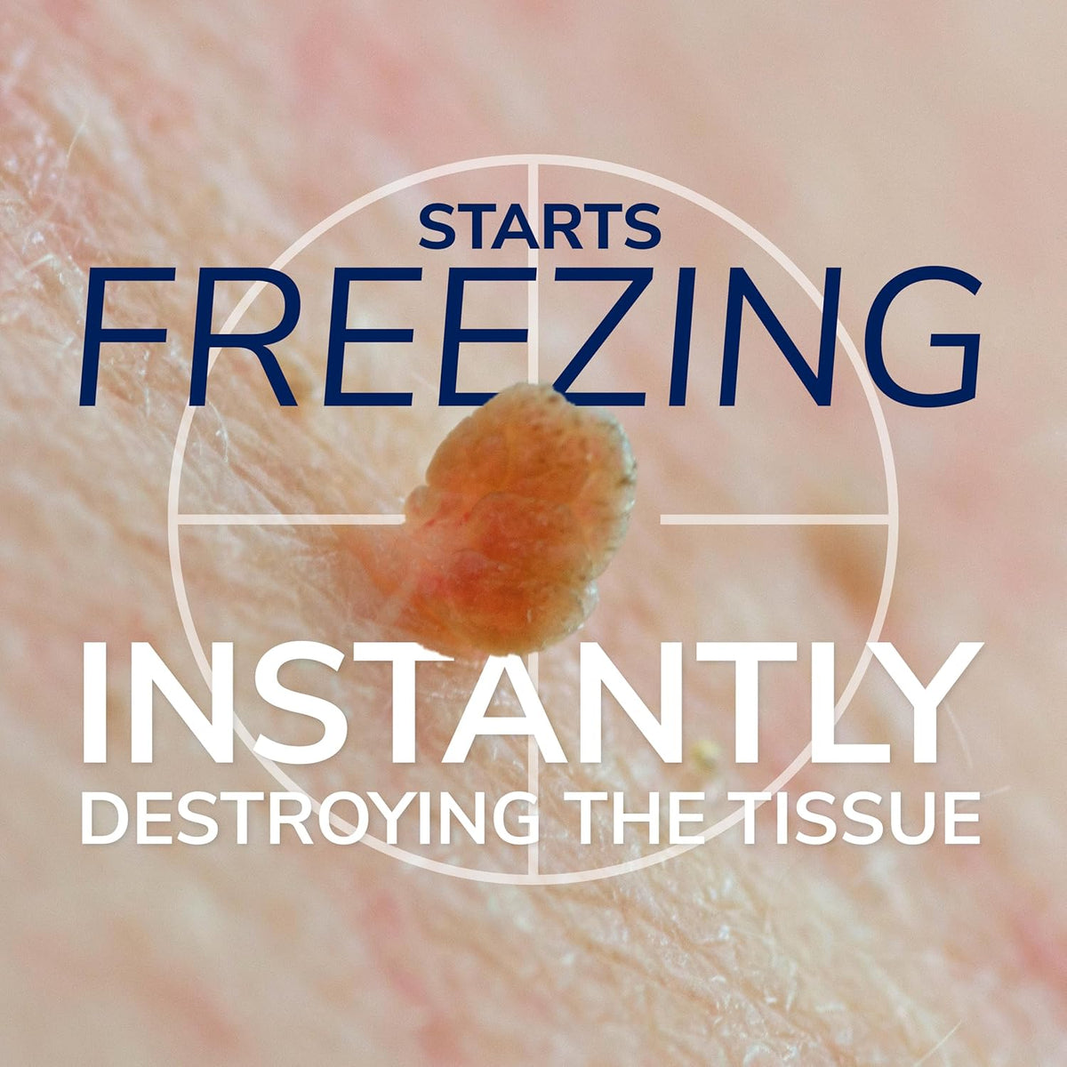 Dr. Scholl's Freeze Away Skin Tag Remover Kit, 8 ct – Completely removes Skin Tags in As Little As