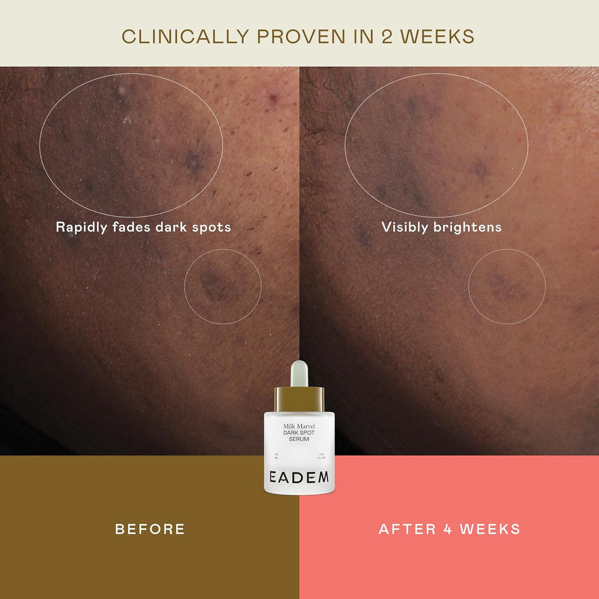 EADEM Milk Marvel Dark Spot Serum, Vitamin C Face Serum Infused with Niacinamide, Dark Spot Remover