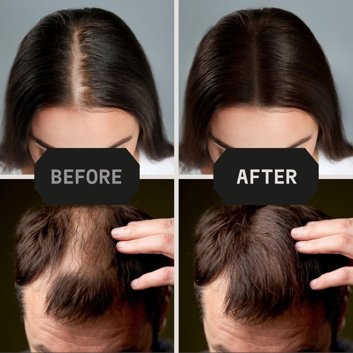 Striking Viking Hair Building Fibers - 28g, Black - Fuller Look Thinning Hair Fibers - Bald Spot