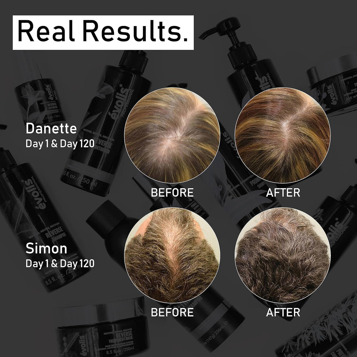 EVOLIS Promote Scalp Activator - Scalp Serum for Longer, Stronger Hair – Hair Repair Treatment