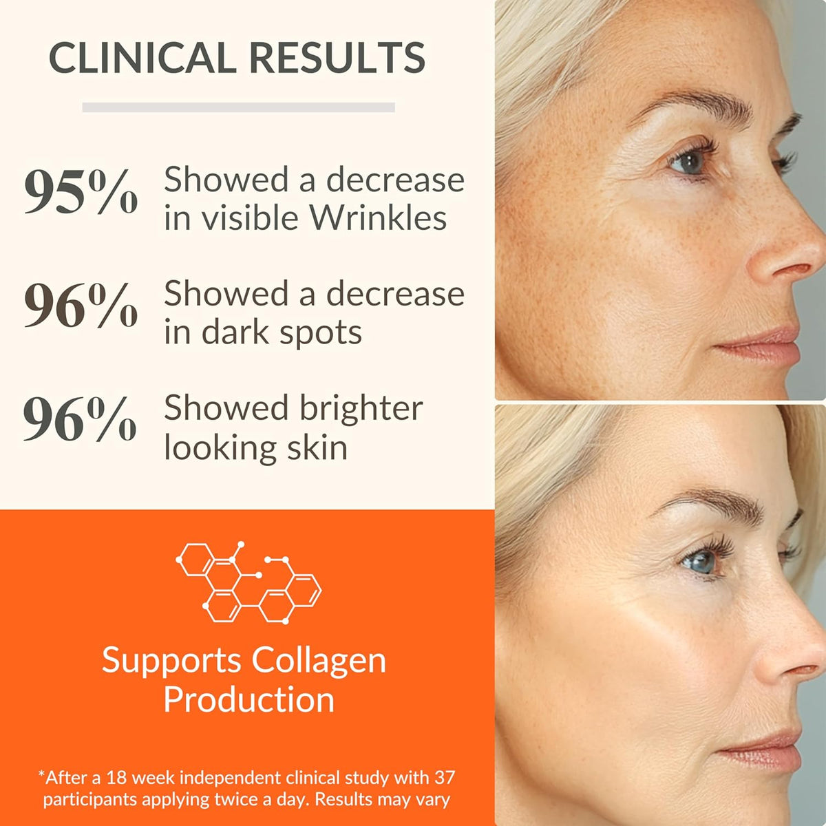 LeVaye Vitamin C Serum, Anti-Aging Face Serum – 15% Vitamin C, Ferulic Acid, Niacinamide