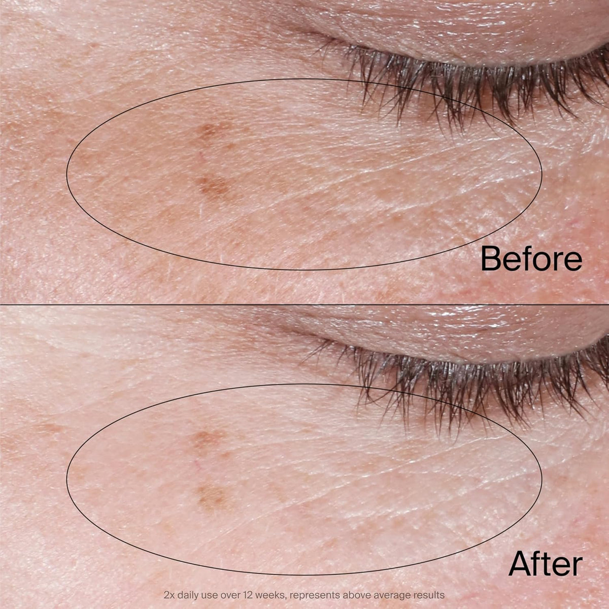 NEUTROGENA Collagen Bank Reviving Eye Cream, Under Eye Cream, Helps Preserve Collagen, Visibly