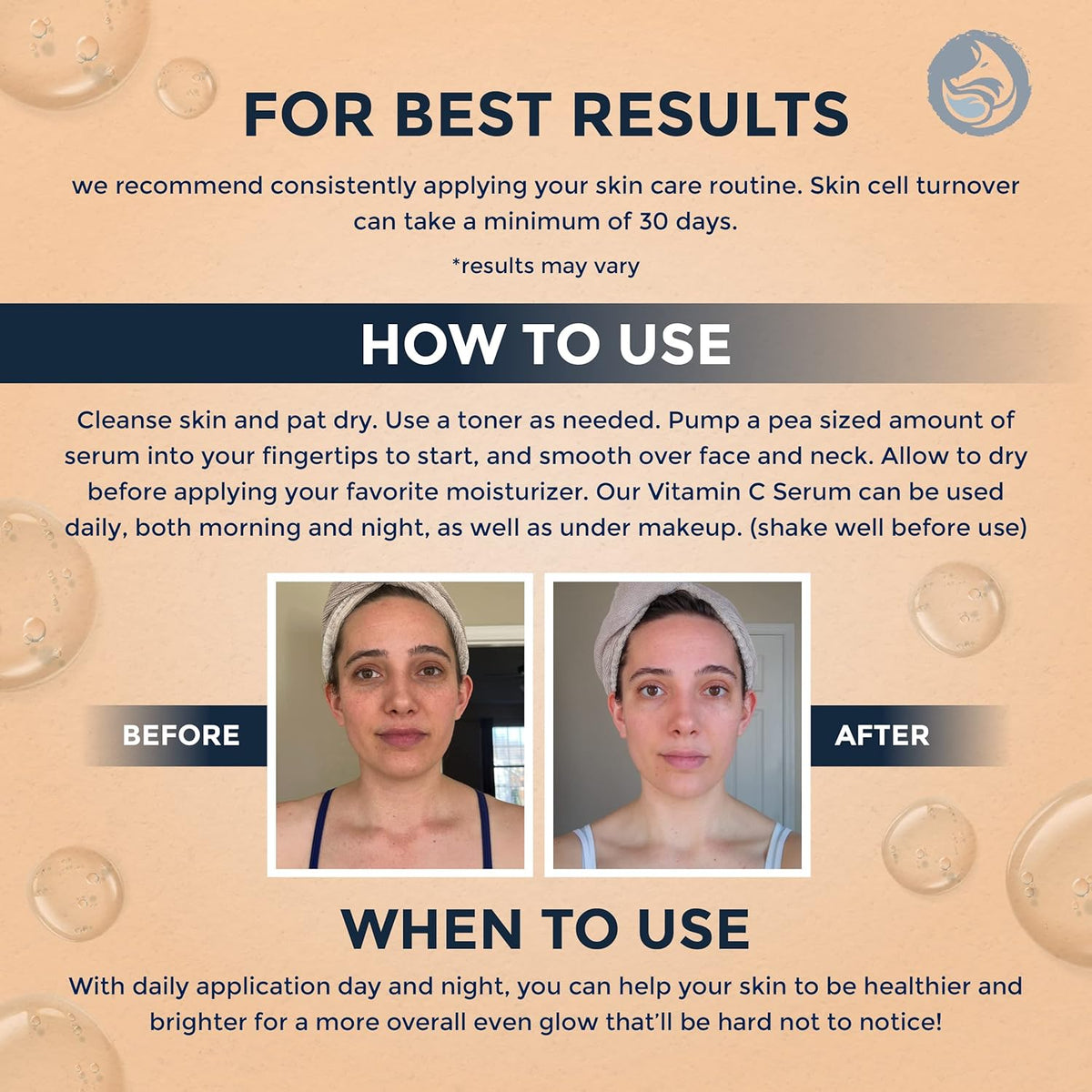 Vitamin C Face Serum 1oz – Stable Formula with Botanical Hyaluronic & Organic Jojoba for Dark