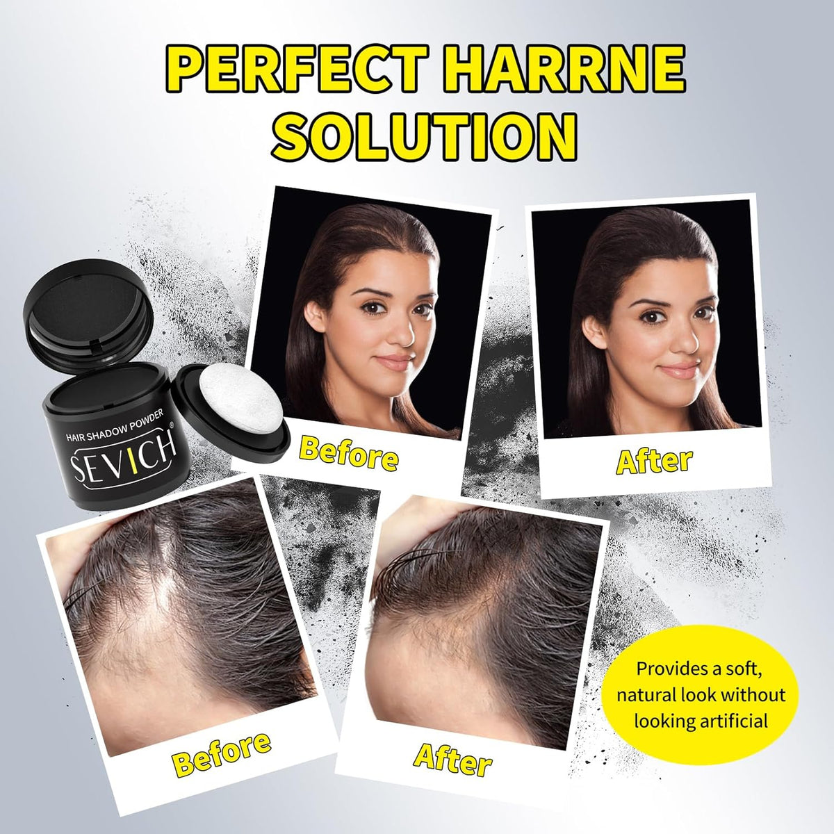 Sevich Hairline Powder 10g Large Capacity,Instantly Conceals Hair Loss,Root Touch up Powder,Hair