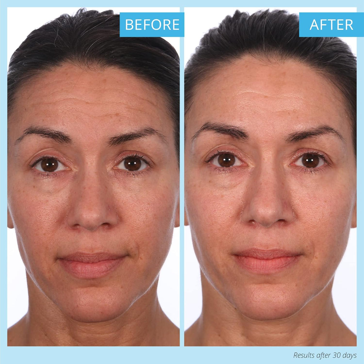 SKINN Crème Reverse with Ferulic Acid, Retinol and Vitamin C-Crème Reverse Intensive-Anti-Aging
