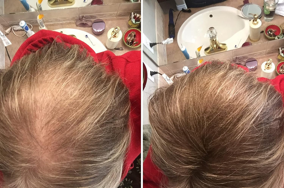 Caboki Hair Loss Concealer. Makes Thin Hair Look 10X Fuller Instantly. Eliminates Bald Spot and