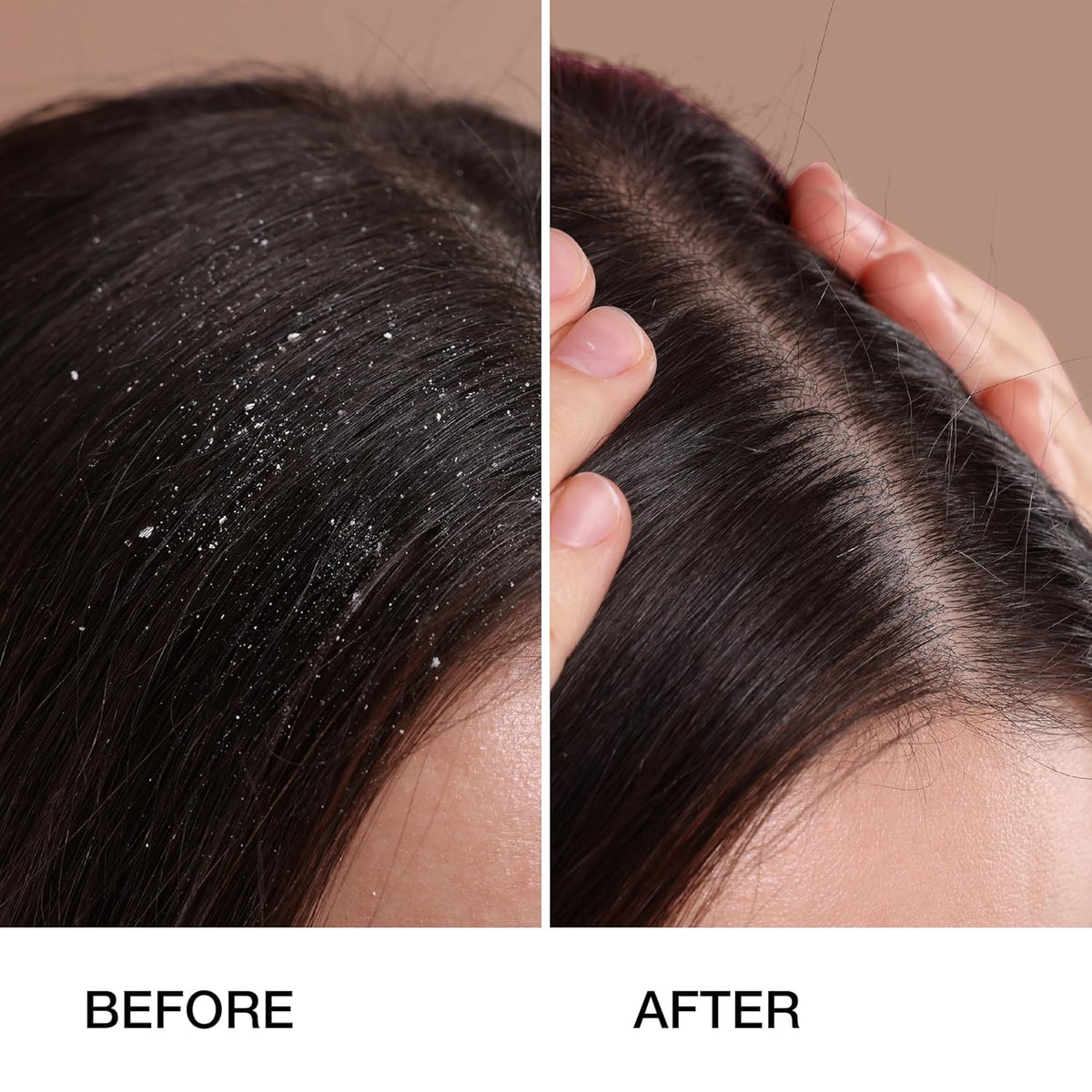 GK HAIR Anti-Dandruff Shampoo Feel the Relief as Itching and Flakes Fade Away, Leaving Your Scalp
