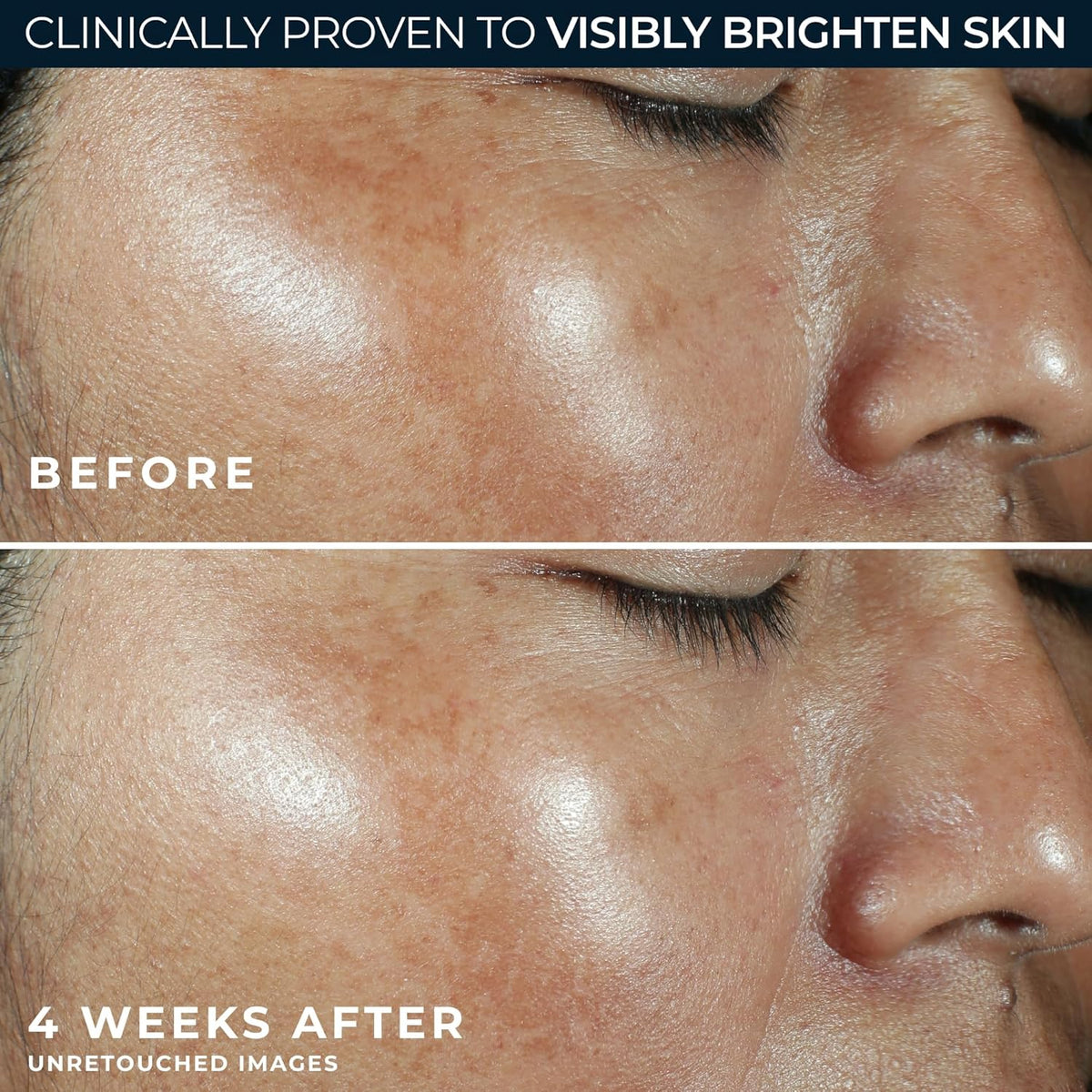 RoC Multi Correxion Revive + Glow Vitamin C Sunscreen Broad Spectrum SPF 30 Face Moisturizer (1.7