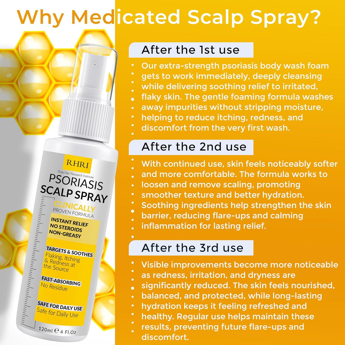 Psoriasis Scalp Spray | Psoriasis and Dandruff Treatment for Scalp Yeast Infections, Psoriasis
