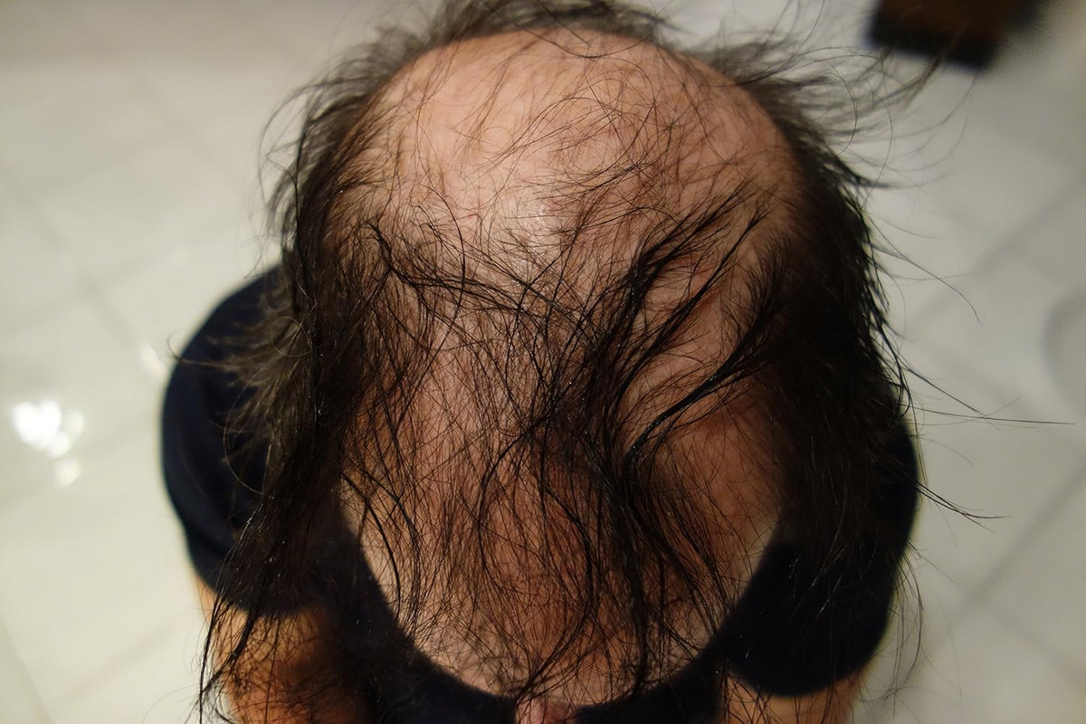 Hair Building Fibers - Soft Black Refill 50 Gram. Conceal Grey Roots with Hair Filler Fibers by