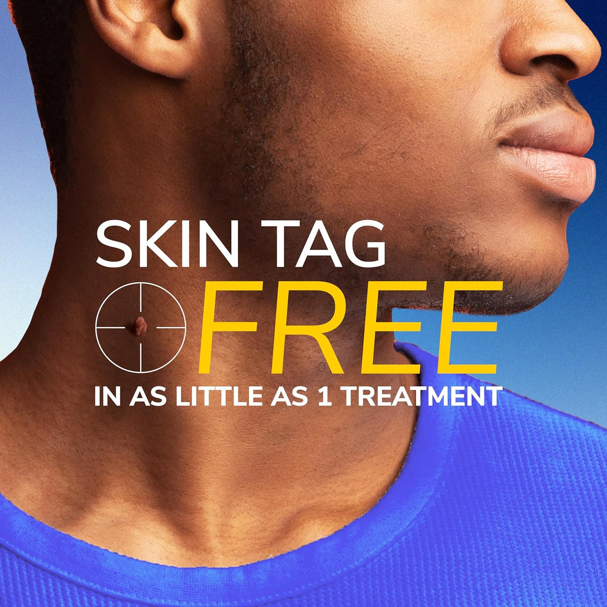 Dr. Scholl's Freeze Away Skin Tag Remover Kit, 8 ct – Completely removes Skin Tags in As Little As