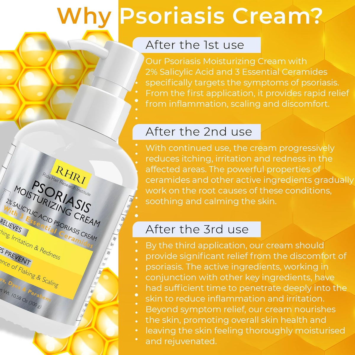 Psoriasis Cream for Itchy Scalp, Face & Body | Eczema Cream for Adults | Psoriasis Treatment for